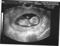 12 week.jpg