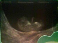 our bean 11 weeks.jpg