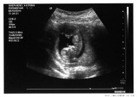 U:S 12 Weeks Scan.jpg