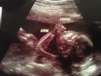 ultrasound 2.jpg