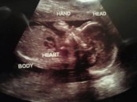 ultrasound 1.jpg