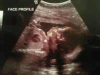 ultrasound 4.jpg