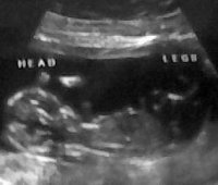 baby13+3boypart.jpg