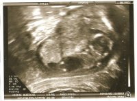 14weekscan2.jpg