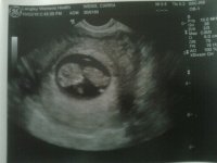 Baby #2 Side profile.jpg