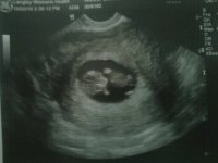 Baby #2 Face and tiny hands!.jpg