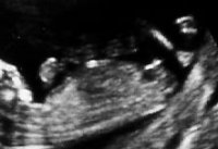 Baby#3-2-2.jpg