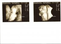Baby @ 13wks 001.jpg