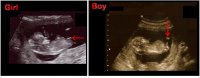 rhondas girl and debbies boys scan compared.JPG