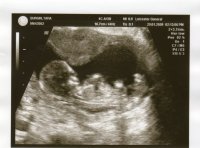 baby1.jpg