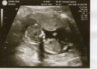 baby.jpg