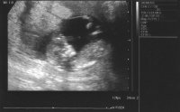 12WEEKSCAN-SMALL-noname.JPG