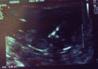 baby6.jpg