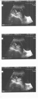 babyy.jpg