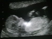 My baby scan 12week.jpg