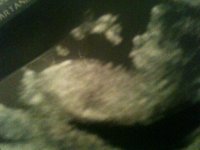 ultraone12weeks2days.jpg