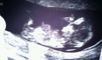 BabyNo3 12 weeks 2 days.jpg
