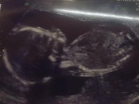 15112010046.jpg