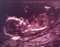 Baby James 14wks.jpg