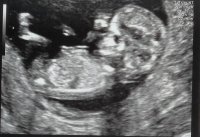 13weeks1.jpg