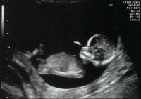 13weeks4.jpg