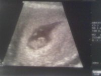 8wk Scan.jpg