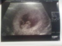 8wk Scan 2.jpg