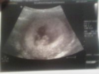8wk Scan 3.jpg