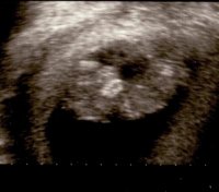 Baby Gibbons At 11 weeks old.jpg