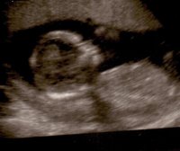 Baby Gibbons At 14 Weeks and 1 Day.jpg