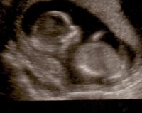 Baby Gibbons At 14 Weeks and 1 Day (2).jpg