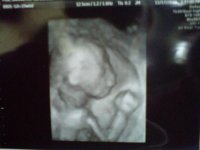 20wk3d1.jpg