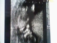 photo 4 Squidge.jpg