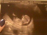 baby 12+4.jpg
