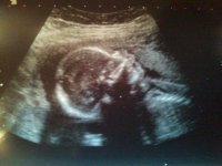 baby bethell 20 weeks.jpg