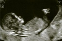 scan 12+1 baby 2 2.jpg