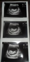 3x10+1wks.jpg