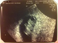 scan 8 weeks.jpg