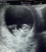 First Ultrasound 12.14.10  9 weeks 3 days.jpg