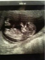 baby no.2.jpg