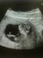baby scan.jpg