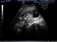 baby 23 sec.jpg