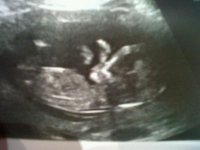 scan 12weeks.jpg
