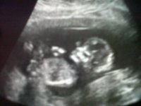12weeks scan 2.jpg
