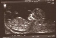 baby 1.jpg