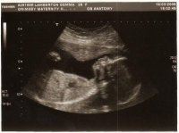 scan 22.5 weeks!!.jpg