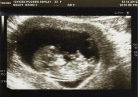 baby scan.jpg