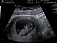 BABY VICTORIA_18.jpg