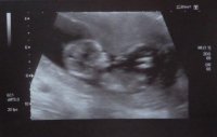 baby 1.jpg
