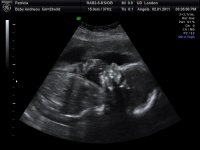 baby 4d scan 23+3 006.jpg